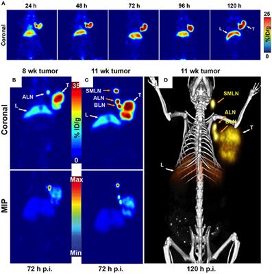 Ovarian Cancer Targeted Theranostics